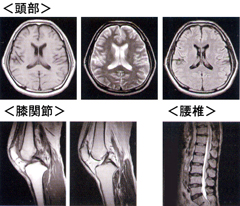 MRI装置による撮像例
